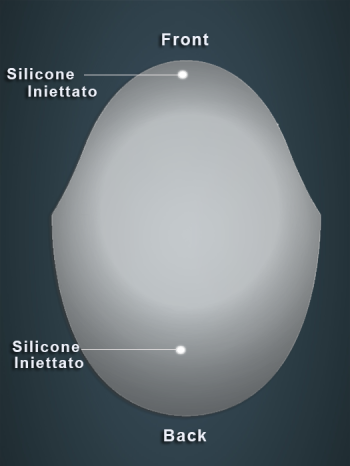 silicone-iniettato-clear.png